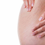 Cómo quitar la celulitis con ejercicios aeróbicos